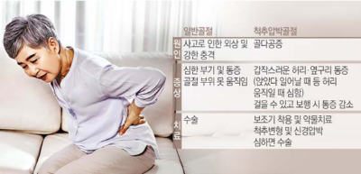 기침 한 번 했을 뿐인데…중장년여성 ‘척추압박골절’ 주의보